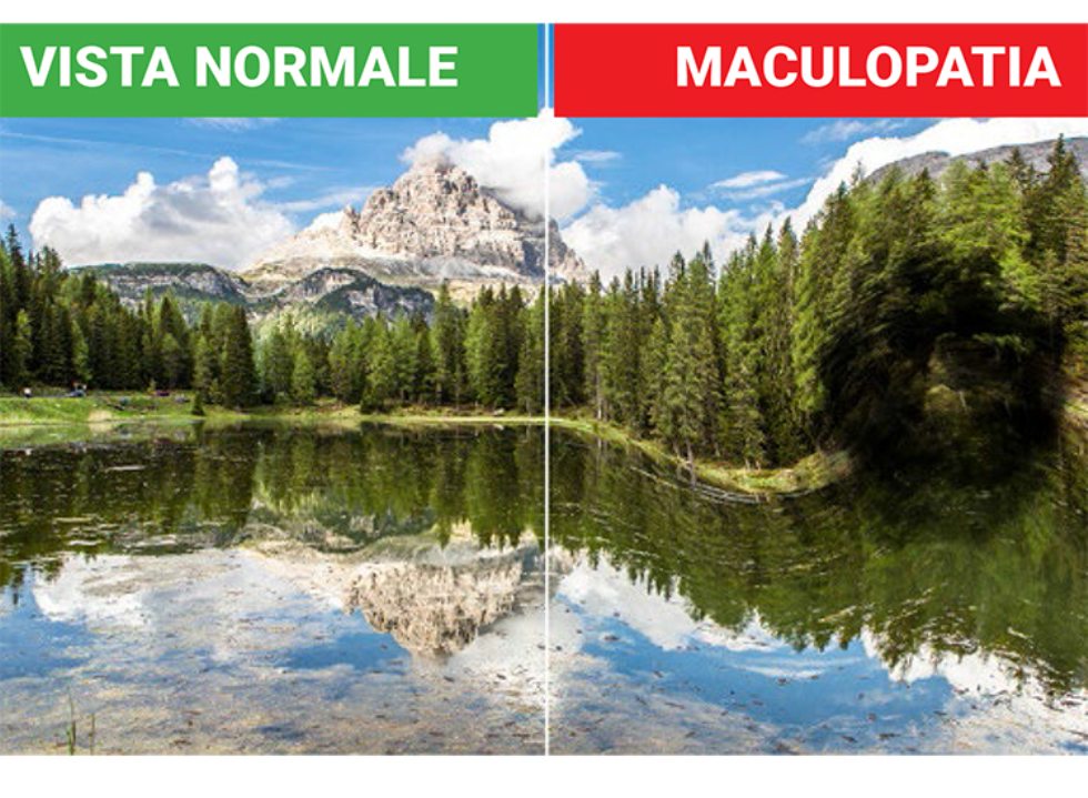 Maculopatia, parte la campagna di prevenzione in Lombardia  